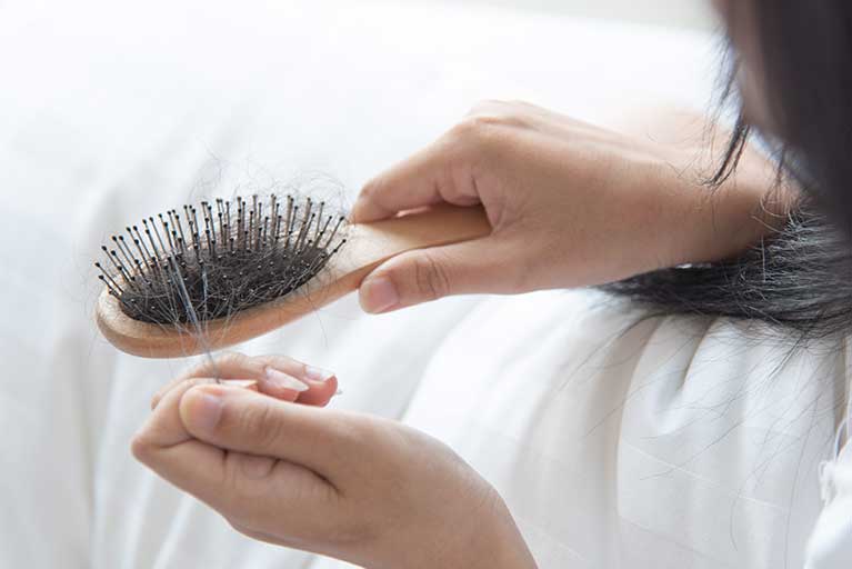 Frau hält Haarbürste mit vielen Haaren in der Hand