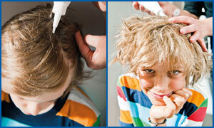 Zwei Fotos nebeneinander illustrieren die Anwendung des Kopfläuse-Mittels Licener von Hennig. Einem Jungen mit mittellangen Haaren wird Licener auf die Kopfhaut aufgetragen.